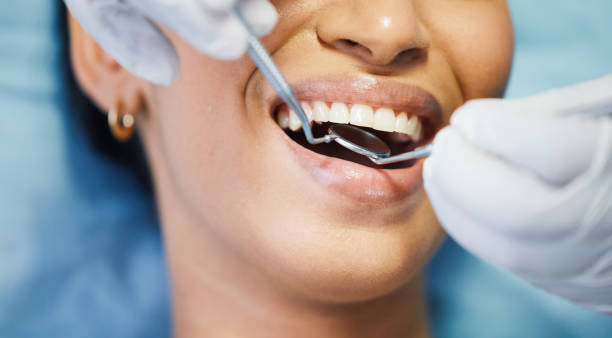 Best Emergency Orthodontic Repairs in Cupertino, CA
